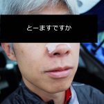 トーマス・チャップルさんの場合